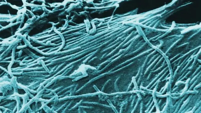 Tan iyo 30kii Janaayo, Uganda waxay soo werisay sagaal xaaladood oo la xaqiijiyay oo ah Fayraska Ebola Suudaan (SVD).