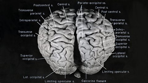 Annotated photograph of Albert Einstein's brain.
