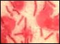 Anthrax spores