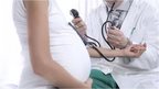 Abortion