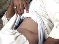 گردہ بیچنے والا شخص