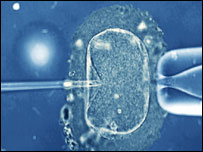 Fertilização in vitro