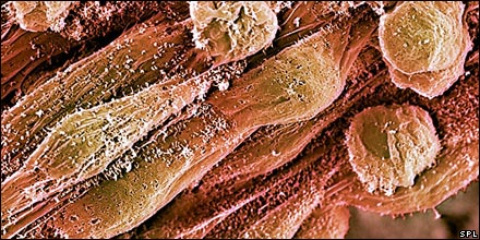Stem Cells