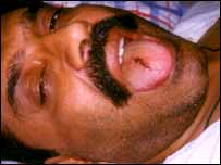 آصف زرداری