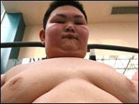 criança obesa